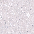Immunohistochemical staining of human cerebral cortex shows no positivity in neurons as expected.