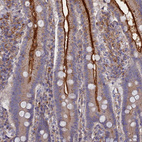 Immunohistochemical staining of human duodenum shows strong membranous positivity in glandular cells.