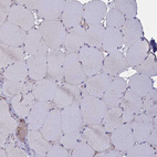 Immunohistochemical staining of human skeletal muscle shows no positivity in myocytes as expected.