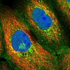 Immunofluorescent staining of human cell line A-431 shows localization to plasma membrane, the Golgi apparatus & vesicles.