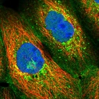 Immunofluorescent staining of human cell line A-431 shows localization to plasma membrane, the Golgi apparatus & vesicles.