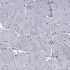 Immunohistochemical staining of human skeletal muscle shows no positivity in myocytes as expected.