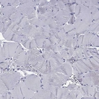 Immunohistochemical staining of human skeletal muscle shows no positivity in myocytes as expected.