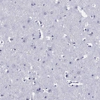 Immunohistochemical staining of human cerebral cortex shows no positivity in neurons as expected.