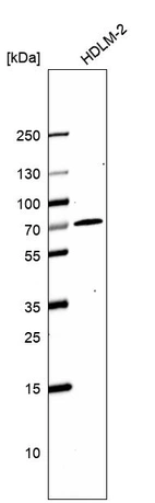 Western blot analysis in human cell line HDLM-2.