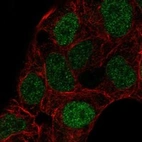 Immunofluorescent staining of human cell line RT4 shows localization to nucleoplasm.
