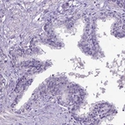 Immunohistochemical staining of human prostate shows no positivity in glandular cells as expected.