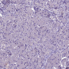 Immunohistochemical staining of human pancreas shows no positivity in exocrine glandular cells as expected.