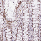 Immunohistochemical staining of human colon shows strong nuclear positivity in glandular cells.
