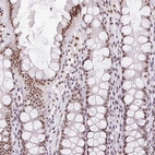 Immunohistochemical staining of human colon shows strong nuclear positivity in glandular cells.