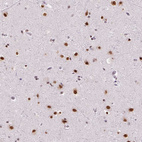 Immunohistochemical staining of human cerebral cortex shows strong nuclear positivity in neurons.