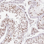 Immunohistochemical staining of human testis shows strong nuclear positivity in cells in seminiferous ducts.