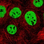 Immunofluorescent staining of human cell line A-431 shows localization to nucleoplasm.
