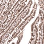 Immunohistochemical staining of human duodenum shows strong nuclear positivity in glandular cells.