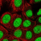 Immunofluorescent staining of human cell line MCF7 shows localization to nucleus.