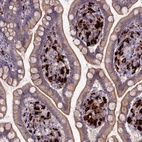 Immunohistochemical staining of human small intestine shows strong cytoplasmic positivity in lymphoid cells.