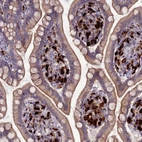 Immunohistochemical staining of human small intestine shows strong cytoplasmic positivity in lymphoid cells.
