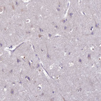 Immunohistochemical staining of human cerebral cortex shows no cytoplasmic positivity in neuronal cells as expected.
