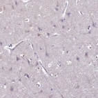 Immunohistochemical staining of human cerebral cortex shows no cytoplasmic positivity in neuronal cells as expected.