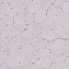 Immunohistochemical staining of human skeletal muscle shows no cytoplasmic positivity in myocytes as expected.