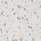 Immunohistochemical staining of human cerebral cortex shows strong cytoplasmic positivity in neurons.