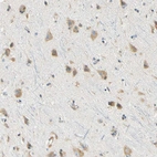 Immunohistochemical staining of human cerebral cortex shows strong cytoplasmic positivity in neurons.
