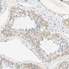 Immunohistochemical staining of human testis shows strong cytoplasmic positivity in cells in seminiferous ducts.