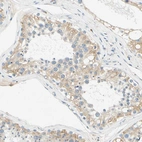 Immunohistochemical staining of human testis shows strong cytoplasmic positivity in cells in seminiferous ducts.