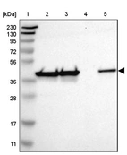 Lane 1: Marker [kDa] 230, 130, 95, 72, 56, 36, 28, 17, 11_br/_Lane 2: Human cell line RT-4_br/_Lane 3: Human cell line U-251MG sp_br/_Lane 4: Human plasma (IgG/HSA depleted)_br/_Lane 5: Human liver tissue