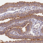 Immunohistochemical staining of human fallopian tube shows strong positivity in cilia in glandular cells.