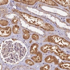 Immunohistochemical staining of human kidney shows strong cytoplasmic positivity in cells in tubules.
