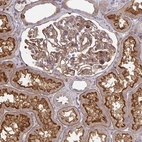 Immunohistochemical staining of human kidney shows strong membranous positivity in cells in glomeruli.