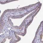 Immunohistochemical staining of human fallopian tube shows strong membranous positivity in glandular cells.