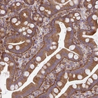 Immunohistochemical staining of human small intestine shows strong membranous positivity in glandular cells.
