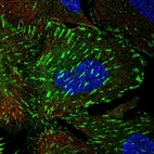 Immunofluorescent staining of human cell line U-2 OS shows localization to cytosol & focal adhesion sites.