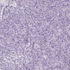 Immunohistochemical staining of human pancreas shows no positivity in exocrine glandular cells as expected.