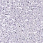 Immunohistochemical staining of human liver shows no positivity in hepatocytes as expected.