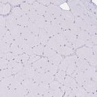 Immunohistochemical staining of human skeletal muscle shows no positivity in myocytes as expected.