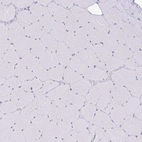 Immunohistochemical staining of human skeletal muscle shows no positivity in myocytes as expected.