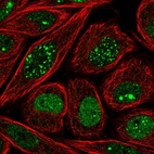Immunofluorescent staining of human cell line SiHa shows localization to nucleoplasm & nuclear bodies.
