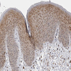 Immunohistochemical staining of human skin shows strong cytoplasmic positivity in squamous epithelial cells.