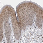 Immunohistochemical staining of human skin shows strong cytoplasmic positivity in squamous epithelial cells.