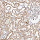 Immunohistochemical staining of human kidney shows strong cytoplasmic positivity in cells in tubules.