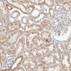 Immunohistochemical staining of human kidney shows strong cytoplasmic positivity in cells in tubules.