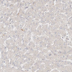 Immunohistochemical staining of human liver shows no positivity in hepatocytes as expected.