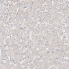 Immunohistochemical staining of human liver shows no positivity in hepatocytes as expected.