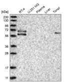 Western blot analysis in human cell line RT-4, human cell line U-251 MG, human plasma, human liver tissue and human tonsil tissue.