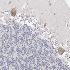 Immunohistochemical staining of human cerebellum shows strong cytoplasmic positivity in Purkinje cells.