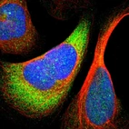 Immunofluorescent staining of human cell line U-2 OS shows localization to nuclear bodies, cytosol & endoplasmic reticulum.