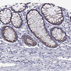 Immunohistochemical staining of human colon shows strong cytoplasmic granular positivity in glandular cells.
